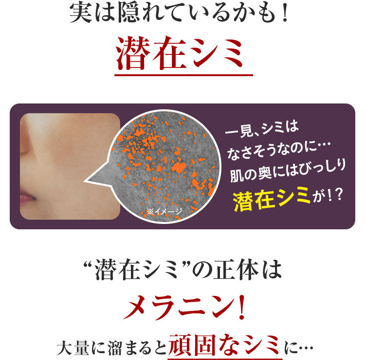 実は隠れているかも！潜在シミ